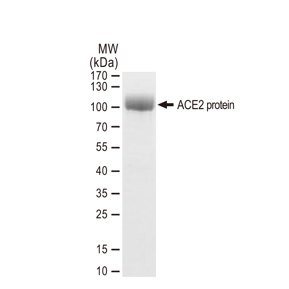 SDS-PAGE of GTX01550-pro Human ACE2 protein, His and Avi tag.