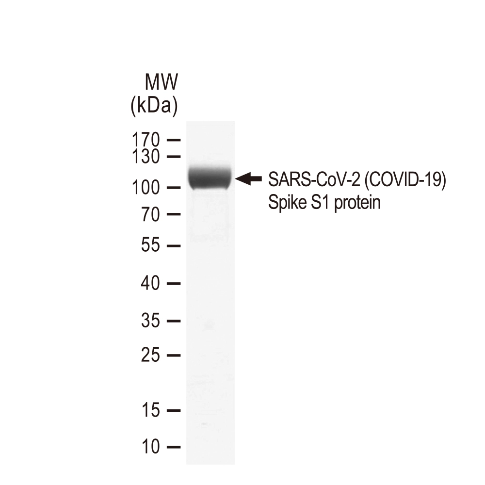 SDS-PAGE of GTX01554-pro SARS-CoV-2 (COVID-19) Spike S1 protein, His tag (active).