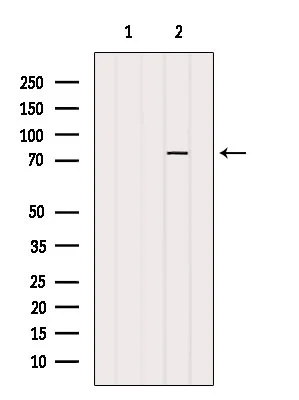 WB analysis of 3T3 cell lysate using GTX01558 PARP2 Antibody. The lane on the left was treated with blocking peptide.
