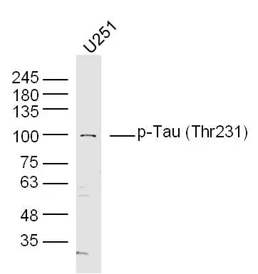WB analysis of U251 cell lysate using GTX01563 Tau (phospho Thr231) antibody.<br>Dilution : 1:300