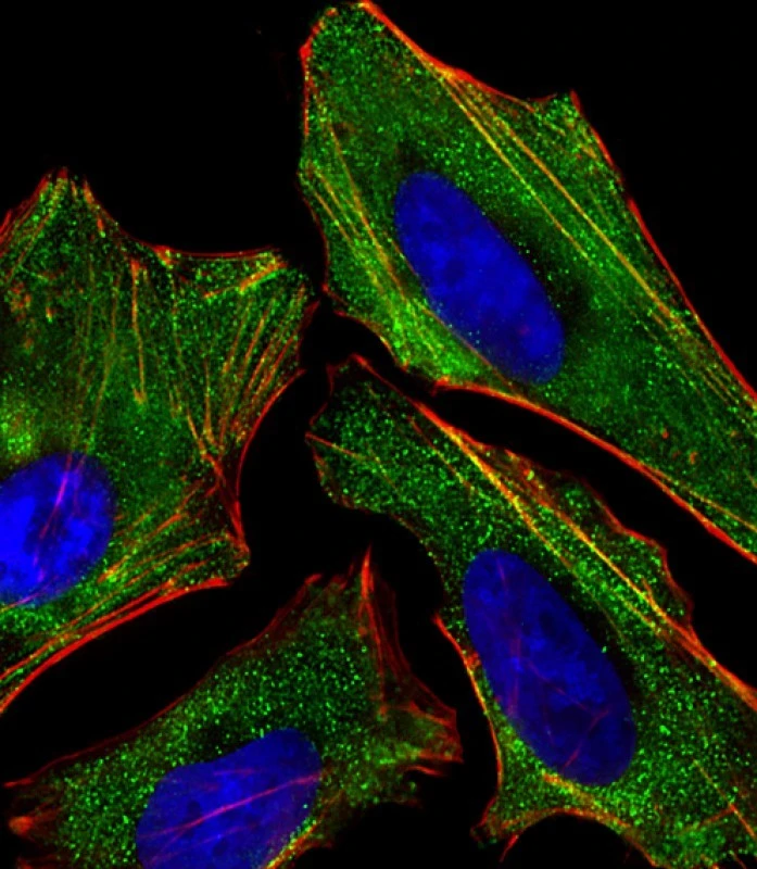 ICC/IF analysis of 4% PFA-fixed HeLa cells using GTX01566 Kiss1 antibody. Green : Primary antibody Red : F-actin Blue : DAPI Permeabilization : 0.1% Triton X-100 Dilution : 1:25 ICC/IF analysis of 4% PFA-fixed HeLa cells using GTX01566 Kiss1 antibody. Green : Primary antibody Red : F-actin Blue : DAPI Permeabilization : 0.1% Triton X-100 Dilution : 1:25