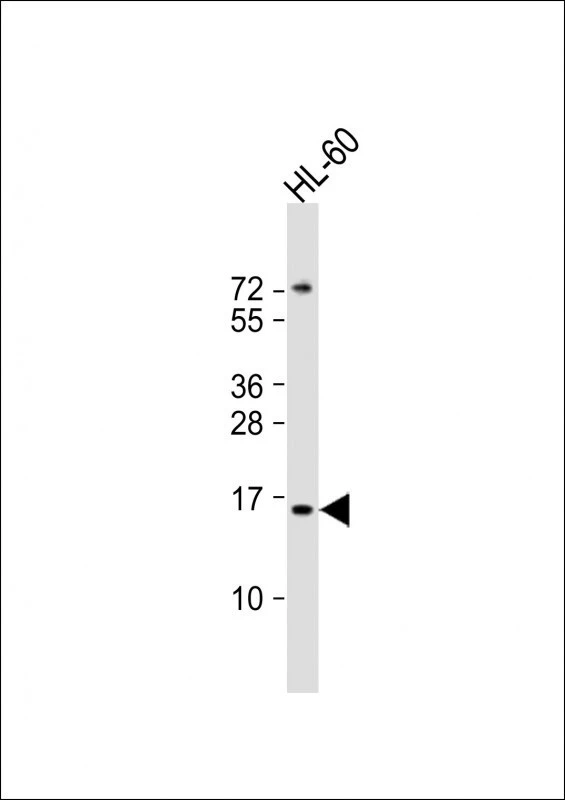 WB analysis of HL-60 whole cell lysate using GTX01566 Kiss1 antibody. Dilution : 1:2000 Loading : 20 microg