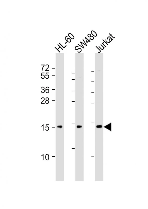 WB analysis of various sample lysates using GTX01566 Kiss1 antibody. Lane 1 : HL-60 whole cell lysates Lane 2 : SW480 whole cell lysates Lane 3 : Jurkat whole cell lysates Dilution : 1:2000 Loading : 20 microg per lane