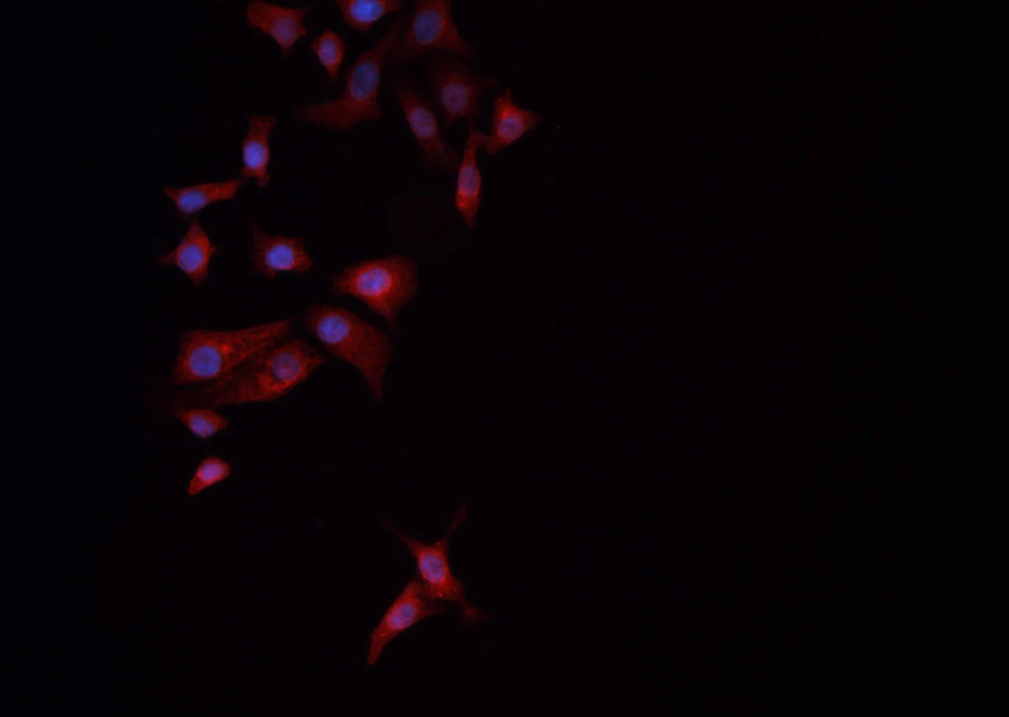 ICC/IF analysis of PFA-fixed NCI-H1299 cells using GTX01567 DRP1 (phospho Ser637) antibody. Permeabilized : 0.1% saponin Dilution : 1:200
