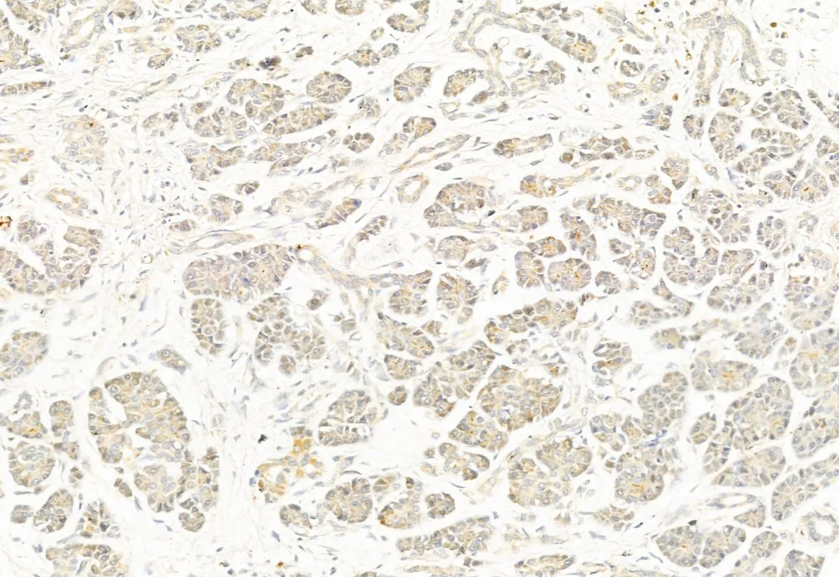 IHC-P analysis of human normal tissue adjacent to pancreatic cancer using GTX01567 DRP1 (phospho Ser637) antibody. Antigen retireval : Heat mediated antigen retrieval step in citrate buffer Dilution : 1:100