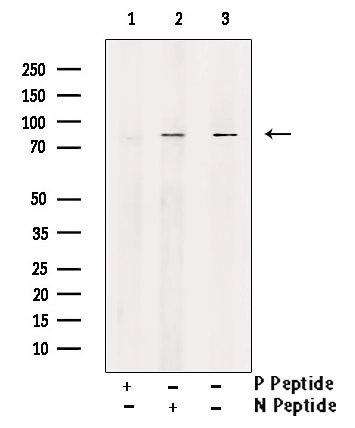 WB analysis of 293 whole cell lysate using GTX01567 DRP1 (phospho Ser637) antibody. Lane 1 : Primary antibody pre-incubated with phospho-blocking peptide Lane 2 : Primary antibody pre-incubated with non-phospho-blocking peptide Lane 3 : untreated sample