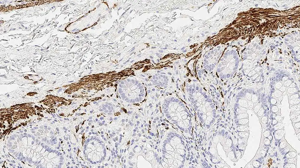 IHC-P analysis of human bowel tissue using GTX01930 Desmin antibody [DE-R-11]. Note cytoplasmic staining of smooth muscle containing cells.
