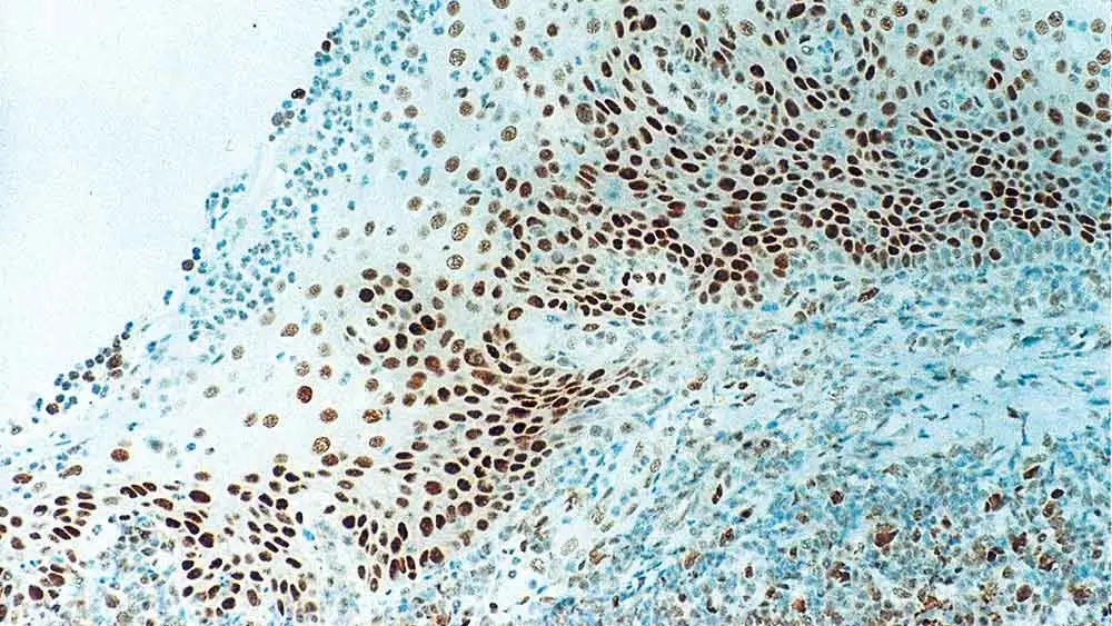 IHC-P analysis of human tonsil tissue using GTX01934 Rb antibody [13A10]. Note intense nuclear staining of epithelial cells.