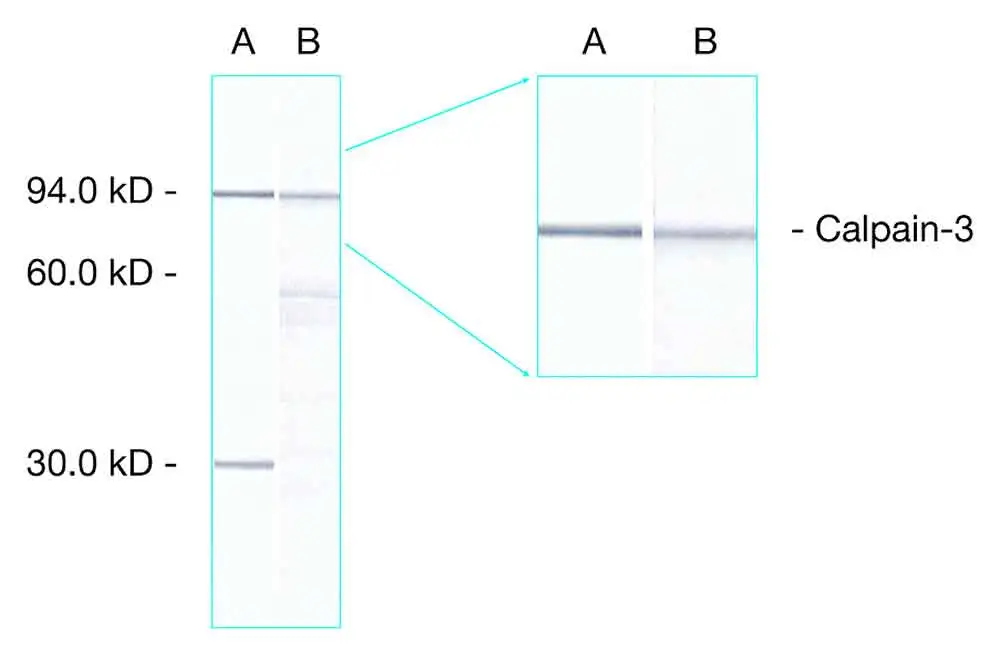 WB analysis of human skeletal muscle tissue lysate using GTX01970 Calpain 3 antibody [Calp3c/12A2] and GTX01970 Calpain 3 antibody [Calp3d/2C4].<br>Lane A : GTX01971<br>Lane B : GTX01970