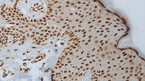 IHC-P analysis of human skin using GTX01979 AKT (phospho Ser473) antibody [LP18].