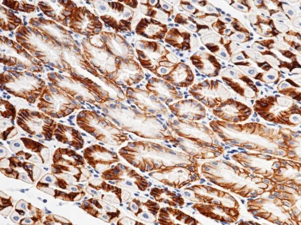 IHC-P analysis of mouse stomach tissue section using GTX01990 Coxsackie Adenovirus Receptor antibody [001].<br>Dilution : 1:200