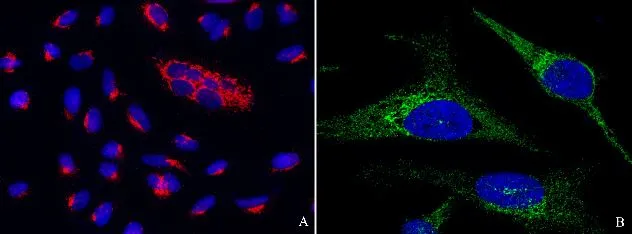 ICC/IF analysis of PFA-fixed A549 or HeLa cells using GTX01995 PTP1B antibody [001].<br>Red : Primary antibody<br>Blue : DAPI<br>Dilution : 1:60