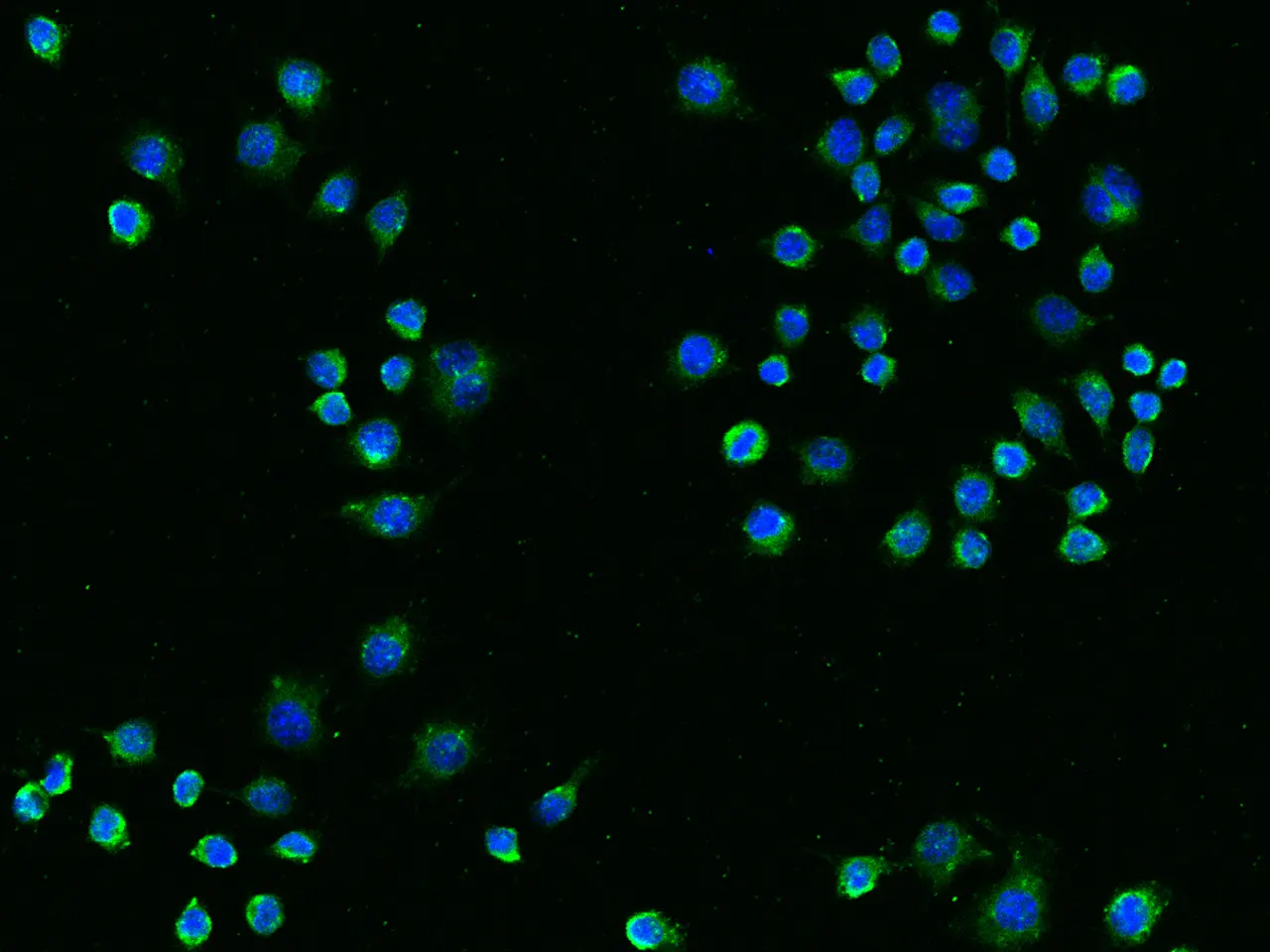 ICC/IF analysis of PFA-fixed RAW264.7 cells using GTX02027 TREM2 antibody [014].<br>Green : Primary antibodyBlue : DAPI<br>Dilution : 1:60