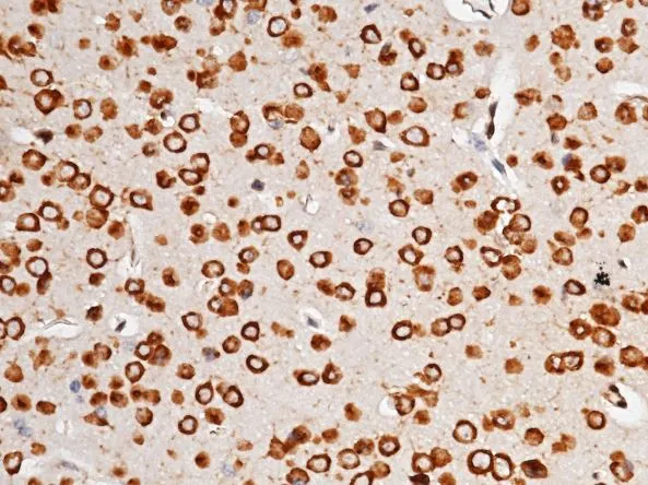 IHC-P analysis of mouse brain tissue section using GTX02049 EIF2C2 antibody [036].<br>Dilution : 1:200