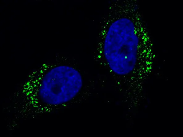 ICC/IF analysis of PFA-fixed HeLa cells using GTX02096 Cathepsin A antibody [104].<br>Green : Primary antibody<br>Blue : DAPI<br>Dilution : 1:60<br>Permeabilzation : 0.3% Triton X-100