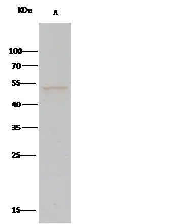 IP analysis of A549 whole cell lysate using GTX02121 PTP1B antibody [226].<br>IP antibody : 2 ?l per 0.5 mg total whole cell lysate<br>Dilution : 1:330<br>50 % Protein G agarose : 15 ?l