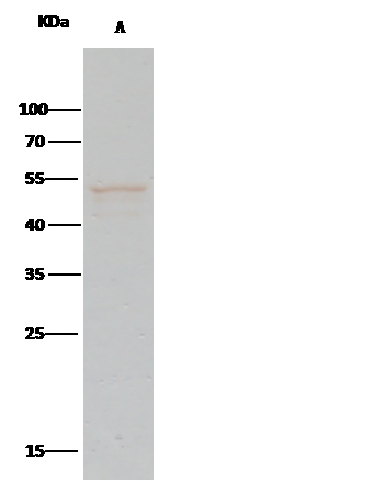 IP analysis of A549 whole cell lysate using GTX02121 PTP1B antibody [226].<br>IP antibody : 2 ?l per 0.5 mg total whole cell lysate<br>Dilution : 1:330<br>50 % Protein G agarose : 15 ?l