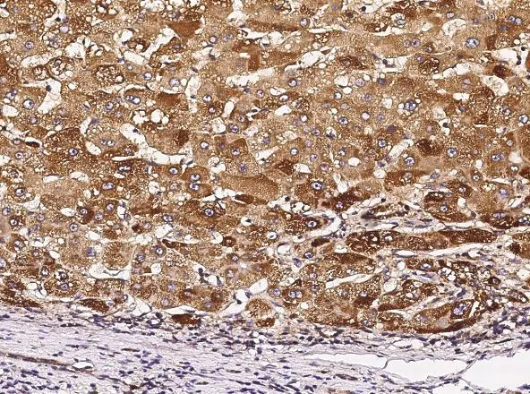 IHC-P analysis of human liver(cirrhosis) tissue section using GTX02146 TIE1 antibody [8D2D2].<br>Dilution : 1:60