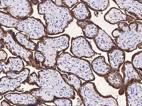 IHC-P analysis of human placenta tissue section using GTX02170 TNF Receptor I antibody. Dilution : 1:1000 IHC-P analysis of human placenta tissue section using GTX02170 TNF Receptor I antibody. Dilution : 1:1000