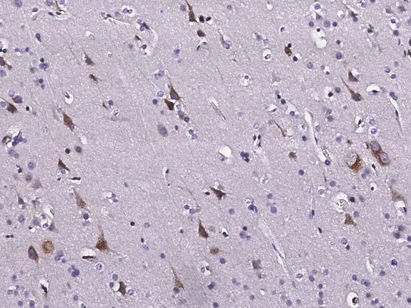 IHC-P analysis of human brain tissue section using GTX02170 TNF Receptor I antibody. Dilution : 1:1000