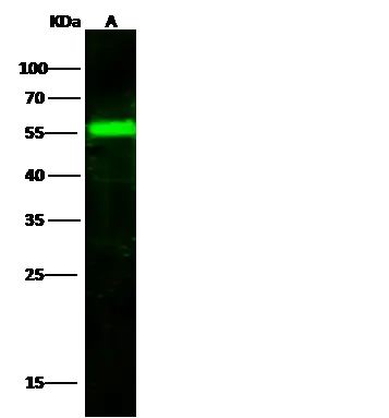 WB analysis of A431 whole cell lysate (Lane A) using GTX02173 Factor IX antibody. Dilution : 1:500 Loading : 30 microg