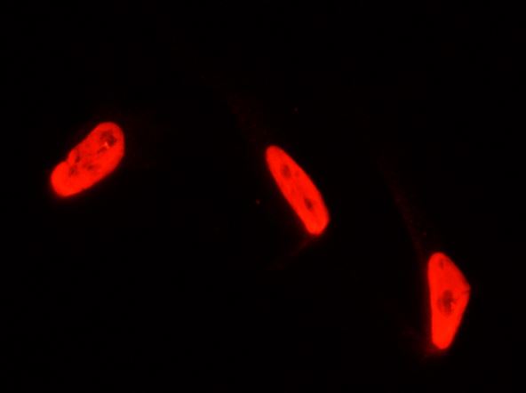 ICC/IF analysis of PFA-fixed HeLa cells using GTX02176 PTBP1 antibody.<br>Red : Primary antibody<br>Dilution : 1:1000<br>Permeabilzation : 0.3% Triton X-100