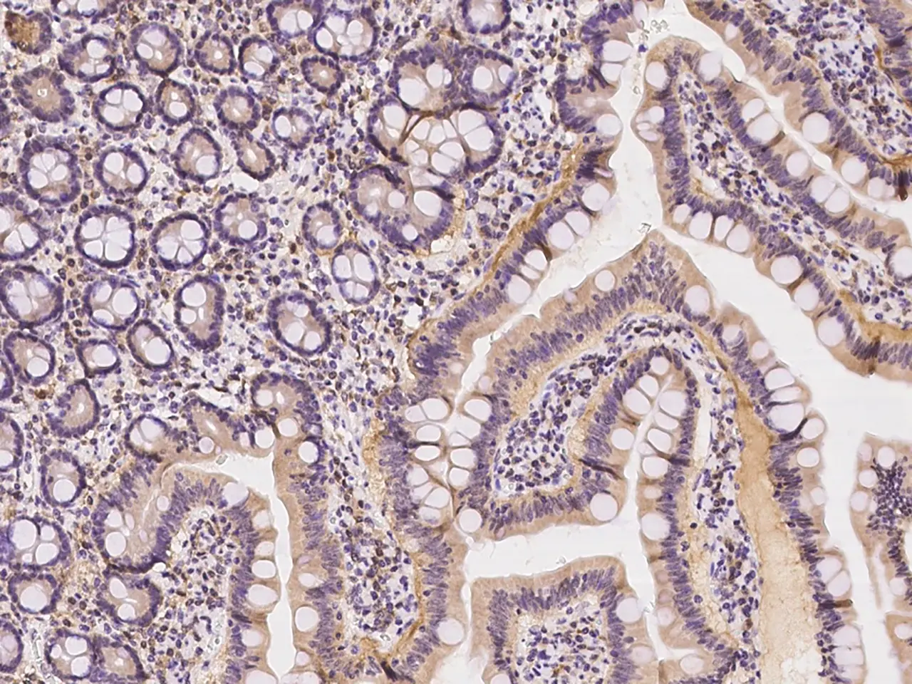 IHC-P analysis of human duodenum tissue section using GTX02183 AFG3L2 antibody.<br>Dilution : 1:1000