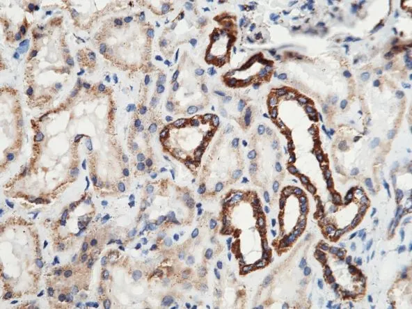 IHC-P analysis of human kidney tissue section using GTX02185 SOD2 antibody.<br>Dilution : 1:1000