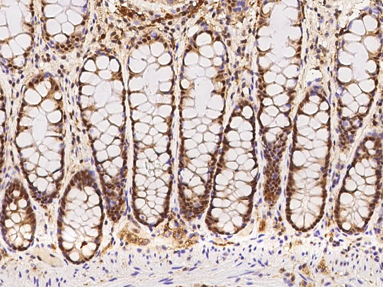 IHC-P analysis of human rectum tissue section using GTX02193 GTF2F2 antibody.<br>Dilution : 1:100