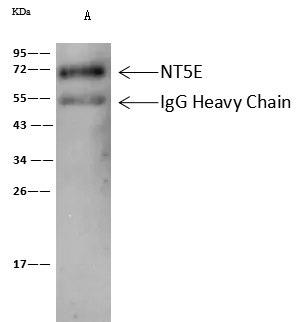 IP analysis of A375 whole cell lysate using GTX02215 CD73 antibody.<br>IP antibody : 0.5 ?l per 0.5 mg total whole cell lysate<br>Dilution : 1:500<br>Immunomagnetic beads Protein A/G :  60 ?g
