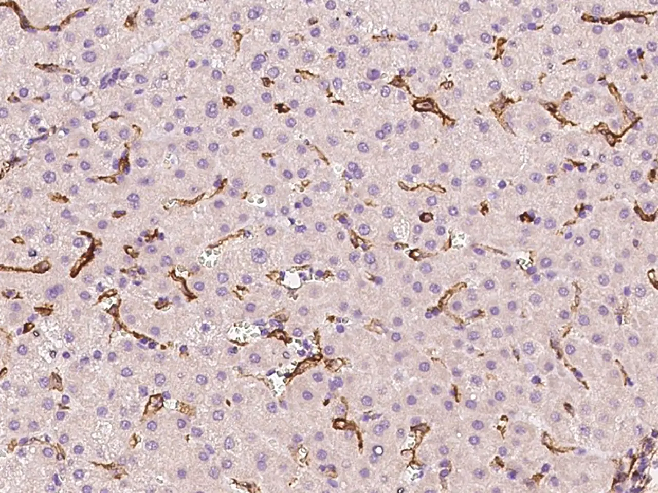 IHC-P analysis of human liver tissue section using GTX02299 VCAM1 / CD106 antibody.<br>Dilution : 1:2000
