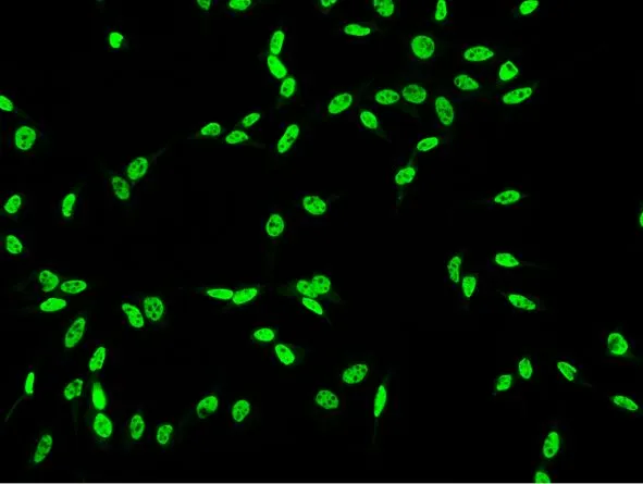 ICC/IF analysis of PFA-fixed HeLa cells using GTX02304 DDX5 antibody.<br>Green : Primary antibody<br>Dilution : 1:1000<br>Permeabilzation : 0.3% Triton X-100