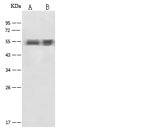 WB analysis of various samples using GTX02323 alpha 1 Antitrypsin antibody.<br>Lane A : Rat Liver tissue lysate<br>Lane B : Rat Spleen tissue lysate<br>Dilution : 1:500<br>Loading : 30 ?g
