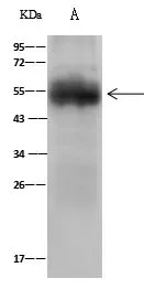 IP analysis of MCF-7 whole cell lysate using GTX02371 alpha 1 Antitrypsin antibody.<br>IP antibody : 0.5 ?l per 0.5 mg total whole cell lysate<br>Dilution : 1:500<br>Immunomagnetic beads Protein A/G :  60 ?g