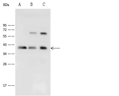 WB analysis of various samples using GTX02380 PP1C gamma antibody.<br>Lane A : 293T whole cell lysate<br>Lane B : HepG2 whole cell lysate<br>Lane C : HeLa whole cell lysate<br>Dilution : 1:500<br>Loading : 30 ?g