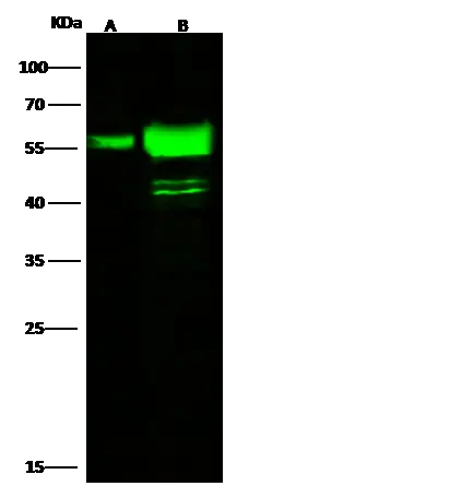 WB analysis of various samples using GTX02384 Cytokeratin 7 antibody.<br>Lane A : HepG2 whole cell lysate<br>Lane B : A431 whole cell lysate<br>Dilution : 1:500<br>Loading : 30 ?g