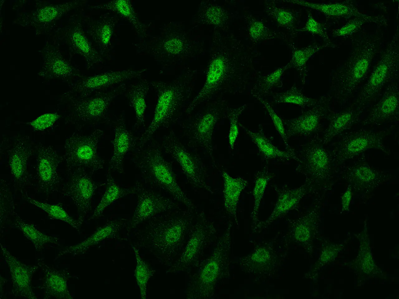 ICC/IF analysis of PFA-fixed HeLa cells using GTX02395 NIPP1 antibody.<br>Green : Primary antibody<br>Dilution : 1:1000<br>Permeabilzation : 0.1% Triton X-100