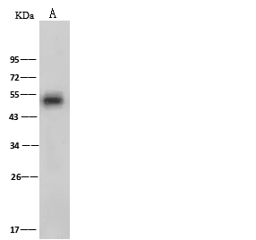 WB analysis of Rat spleen tissue lysate (Lane A) using GTX02436 PEDF antibody.<br>Dilution : 1:500<br>Loading : 30 ?g