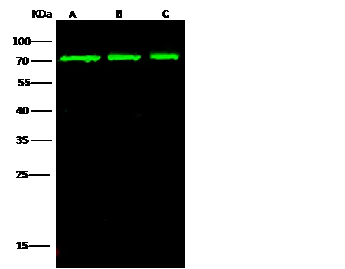 WB analysis of various samples using GTX02484 ABCG2 antibody.<br>Lane A : HepG2 whole cell lysate<br>Lane B : Jurkat whole cell lysate<br>Lane C : COS7 whole cell lysate<br>Dilution : 1:500<br>Loading : 30 ?g