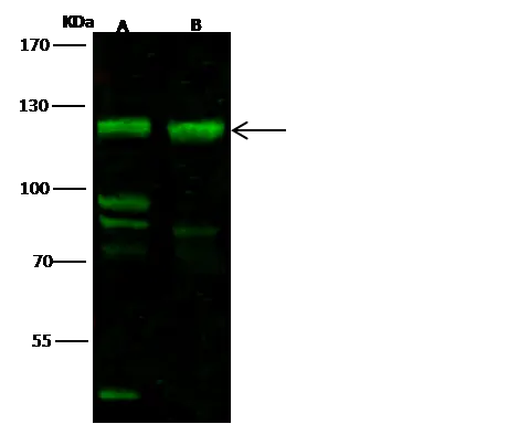 WB analysis of various samples using GTX02499 FBXO11 antibody.<br>Lane A : 293T whole cell lysate<br>Lane B : HeLa whole cell lysate<br>Dilution : 1:500<br>Loading : 30 ?g