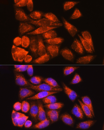 ICC/IF analysis of HeLa cells using GTX02526 ODF2 antibody.<br>Red : Primary antibody<br>Blue : DAPI<br>Dilution : 1:100