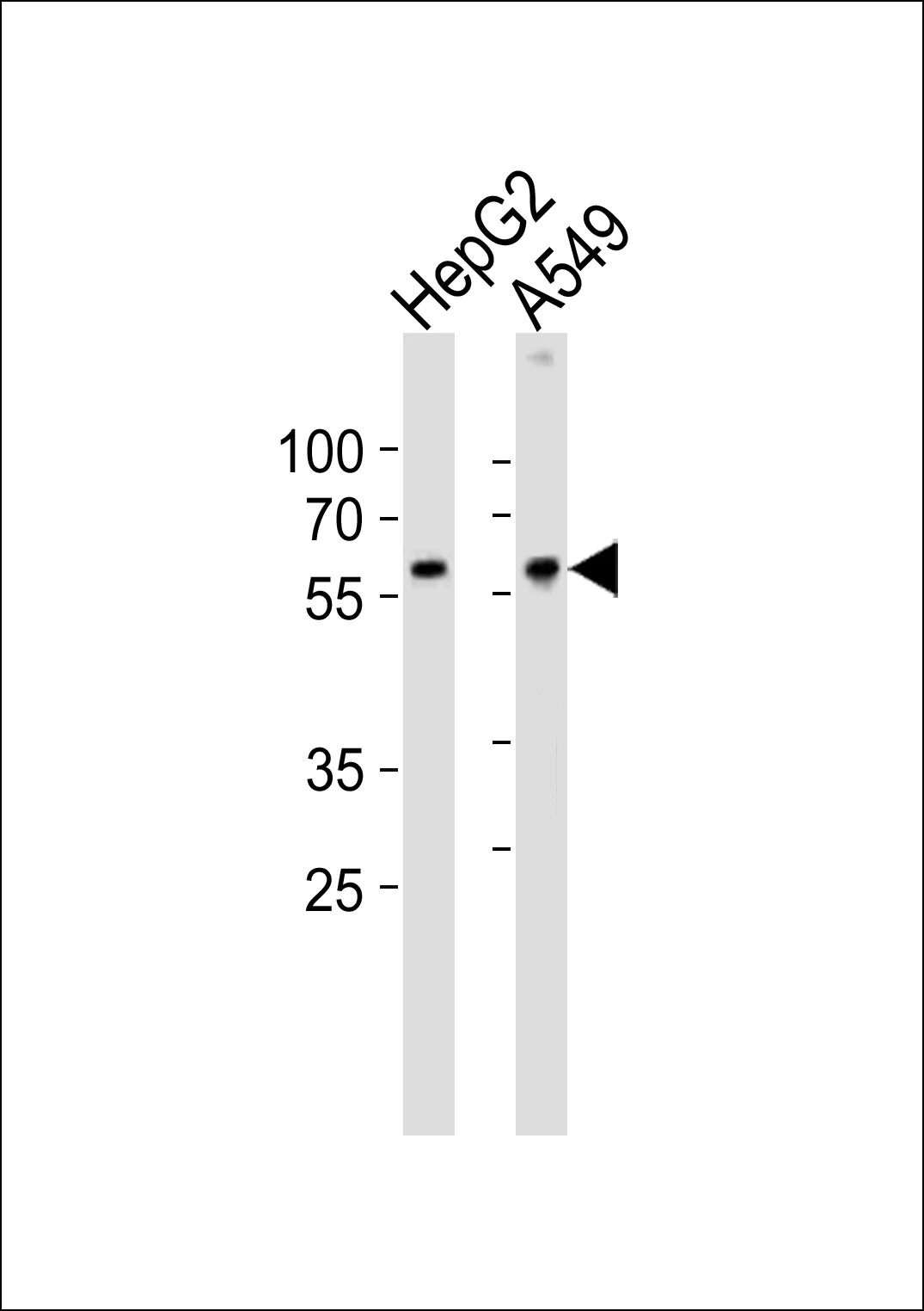 WB analysis of various cell lysates using GTX02528 USP22 antibody. Dilution : 1:1000 Loading : 20microg