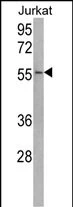 WB analysis of Jurkat cell lysate using GTX02528 USP22 antibody. Loading : 35microg