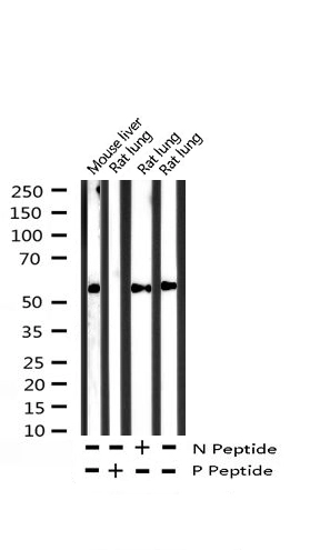 WB analysis of extracts from mouse liver and rat lung tissue using GTX02531 PPAR gamma (phospho Ser112) antibody.<br>N peptide : Non-phospho peptide<br>P peptide : Phospho peptide