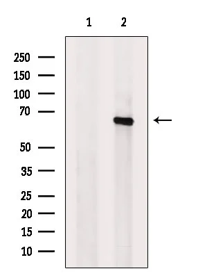 WB analysis of extracts from mouse testis tissue using GTX02536 USP22 Antibody. The lane on the left was treated with blocking peptide. WB analysis of extracts from mouse testis tissue using GTX02536 USP22 Antibody. The lane on the left was treated with blocking peptide.