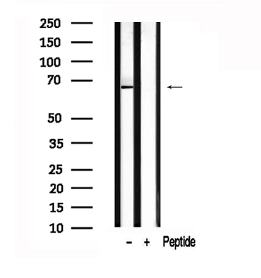 WB analysis of lysates of HEK293 cells using GTX02536 USP22 Antibody.