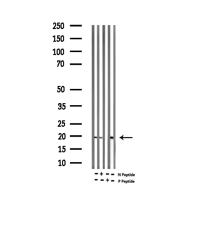 WB analysis of extracts from rat and mouse brain tissue using GTX02537 alpha Synuclein (phospho Ser129) antibody.<br>N peptide : Non-phospho peptide<br>P peptide : Phospho peptide
