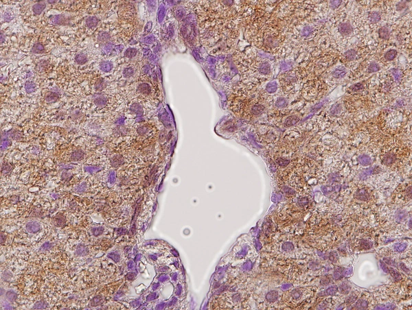 IHC-P analysis of tammar wallaby (Macropus eugenii) liver tissue using GTX02538 Growth hormone Receptor antibody. Dilution : 1:300