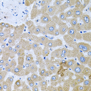 IHC-P analysis of human liver (damage) tissue using GTX02543 POMGNT1 antibody.<br>Dilution : 1:100