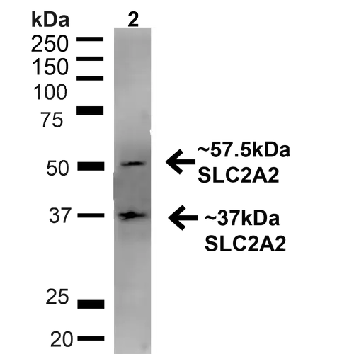 WB analysis of rat liver tissue lysate using GTX02544 GLUT2 antibody. Dilution : 1:1000 Loading : 20 microg